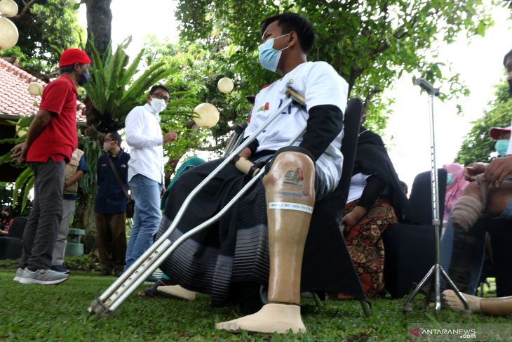Program-Bantuan-Kaki-Palsu-Untuk-Penyandang-Disabilitas,-Ini-Syaratnya